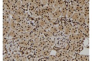 ABIN6277344 at 1/100 staining Rat kidney tissue by IHC-P. (VCP anticorps  (Internal Region))
