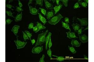Immunofluorescence of monoclonal antibody to LETM1 on HeLa cell.
