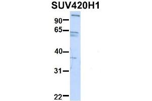Host:  Rabbit  Target Name:  GNAS  Sample Type:  Human Fetal Heart  Antibody Dilution:  1.
