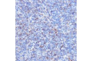 Immunohistochemistry of paraffin-embedded mouse spleen using NOTCH3 antibody (ABIN6134401, ABIN6144738, ABIN6144739 and ABIN6217553) at dilution of 1:100 (40x lens). (NOTCH3 anticorps  (C-Term))
