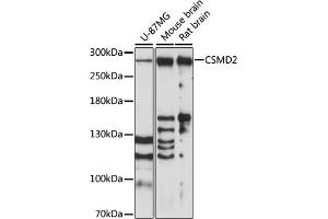 Western blot analysis of extracts of various cell lines, using CSMD2 antibody (ABIN7266537) at 1:1000 dilution. (CSMD2 anticorps  (AA 2050-2150))
