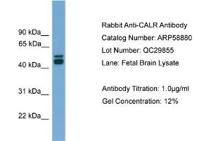 WB Suggested Anti-CALR  Antibody Titration: 0. (Calreticulin anticorps  (Middle Region))