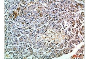 Immunohistochemical analysis of paraffin-embedded human-pancreas, antibody was diluted at 1:200 (MIA2 anticorps  (AA 361-410))