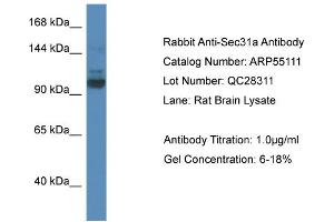 Western Blotting (WB) image for anti-SEC31 Homolog A (SEC31A) (N-Term) antibody (ABIN2786062) (SEC31A anticorps  (N-Term))