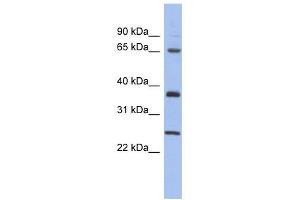 HORMAD2 antibody used at 1 ug/ml to detect target protein. (HORMAD2 anticorps  (Middle Region))
