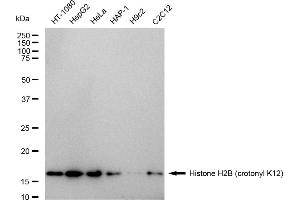Western blotting analysis using Histone H2B (crotonyl K12) antibody (ABIN7798945).