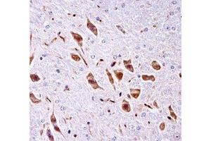PAK3 antibody immunohistochemistry analysis in formalin fixed and paraffin embedded mouse brain tissue.