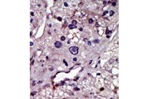 Image no. 1 for anti-Cytidine Monophosphate (UMP-CMP) Kinase 1, Cytosolic (CMPK1) (N-Term) antibody (ABIN360613)