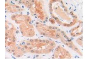 IHC-P analysis of Human Kidney Tissue, with DAB staining.