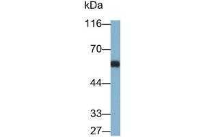 Detection of OCTN1 in Rat Thymus lysate using Polyclonal Antibody to Organic Cation/Ergothioneine Transporter (OCTN1) (SLC22A4 anticorps  (AA 42-141))