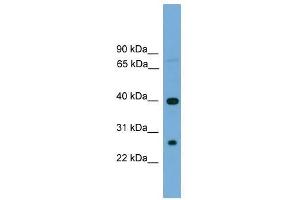 TREML2 antibody used at 0.