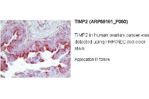 Image no. 2 for anti-Metalloproteinase Inhibitor 2 (TIMP2) (Middle Region) antibody (ABIN2787968) (TIMP2 anticorps  (Middle Region))