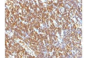 Formalin-fixed, paraffin-embedded human tonsil stained with SUMO-2 antibody (SUMO2/1199)