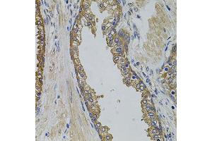 Immunohistochemistry of paraffin-embedded human prostate using PIK3C3 antibody (ABIN2737377) at dilution of 1:100 (40x lens). (PIK3C3 anticorps)