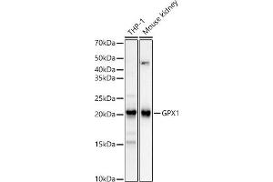 Western blot analysis of extracts of various cell lines, using GPX1 Rabbit mAb (ABIN7267434) at 1:12000 dilution. (Glutathione Peroxidase 1 anticorps)