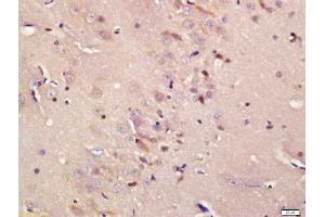 Formalin-fixed and paraffin embedded rat brain labeled with Rabbit Anti-ADCY5 Polyclonal Antibody, Unconjugated  at 1:200 followed by conjugation to the secondary antibody and DAB staining (ADCY5 anticorps  (AA 857-909))