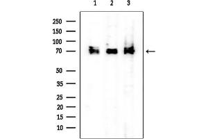 anti-Epithelial Splicing Regulatory Protein 2 (ESRP2) (N-Term) antibody