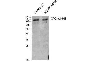 Western Blot (WB) analysis of HepG2-UV, Mouse Brain cells using Acetyl-CRM1 (K568) Polyclonal Antibody. (XPO1 anticorps  (acLys568))