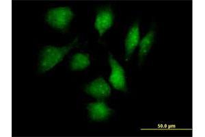Immunofluorescence of purified MaxPab antibody to TXNDC3 on HeLa cell.