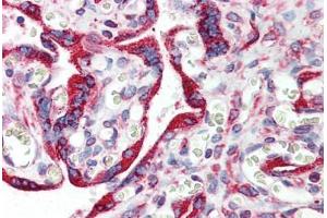 Human Placenta: Formalin-Fixed, Paraffin-Embedded (FFPE)