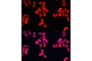 Immunofluorescence analysis of HeLa cells using ENO3 antibody (ABIN7266960) at dilution of 1:100. (ENO3 anticorps  (AA 1-190))