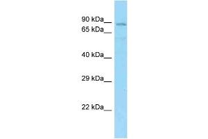 WB Suggested Anti-SHCBP1L Antibody Titration: 1. (SHCBP1L anticorps  (N-Term))