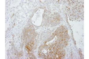 Immunohistochemistry (IHC) image for anti-Protein Arginine Methyltransferase 5 (PRMT5) (C-Term) antibody (ABIN7448743) (PRMT5 anticorps  (C-Term))