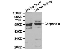 Western blot analysis of extracts of mouse heart and kidney tissue, using CASP9 antibody. (Caspase 9 anticorps)