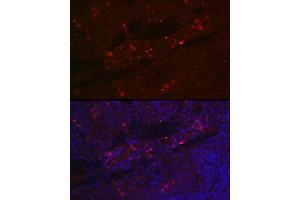Immunofluorescence analysis of rat spleen cells using CD25 Rabbit pAb (ABIN3017118, ABIN3017119, ABIN3017120 and ABIN6219963) at dilution of 1:100 (40x lens). (CD25 anticorps)