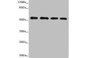 Western blot All lanes: CALCOCO2 antibody at 3. (CALCOCO2 anticorps  (AA 137-446))