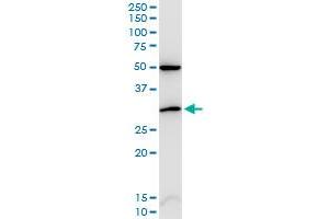 CDKN1B monoclonal antibody (M02), clone 2F4. (CDKN1B anticorps  (AA 100-198))