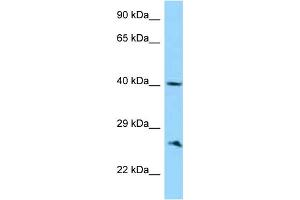 WB Suggested Anti-ABI1 Antibody Titration: 1. (ABI1 anticorps  (C-Term))