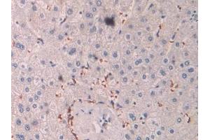 Detection of OAS1 in Human Liver Tissue using Polyclonal Antibody to 2',5'-Oligoadenylate Synthetase 1 (OAS1) (OAS1 anticorps  (AA 74-165))