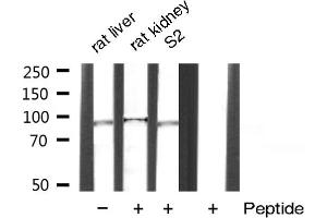 Western blot analysis of extracts of various sample,using Catenin-β antibody.