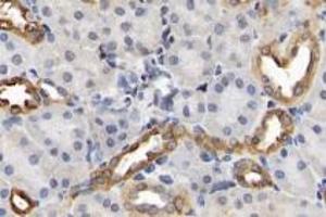 Immunohistochemistry analysis of paraffin-embedded rat kidney using,Claudin 10 (ABIN7073514) at dilution of 1: 2000 (CLDN10 anticorps)