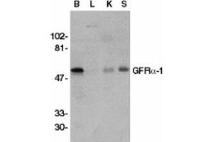 Image no. 2 for anti-GDNF Family Receptor alpha 1 (GFRA1) (AA 369-382) antibody (ABIN201472) (GFRA1 anticorps  (AA 369-382))