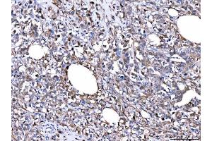 IHC analysis of FHL2 using anti-FHL2 antibody (ABIN7600782). (FHL2 anticorps  (AA 234-279))