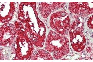 Detection of ANXA4 in Human Kidney Tissue using Polyclonal Antibody to Annexin A4 (ANXA4)