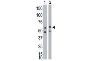 Image no. 1 for anti-Bone Morphogenetic Protein Receptor 1A (BMPR1A) (Middle Region) antibody (ABIN357375) (BMPR1A anticorps  (Middle Region))