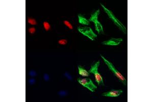 HDGFRP3 Antibody staining Hela cells by IF/ICC. (HDGFRP3 anticorps  (Internal Region))