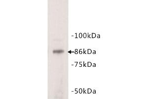 Western Blotting (WB) image for anti-Signal Transducer and Activator of Transcription 3 (Acute-Phase Response Factor) (STAT3) (N-Term) antibody (ABIN1854975) (STAT3 anticorps  (N-Term))