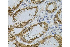 Immunohistochemistry of paraffin-embedded Human stomach using SIGMAR1 Polyclonal Antibody (SIGMAR1 anticorps)