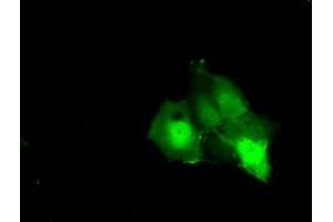 Anti-KHK mouse monoclonal antibody (ABIN2453198) immunofluorescent staining of COS7 cells transiently transfected by pCMV6-ENTRY KHK (RC202424). (Ketohexokinase anticorps)