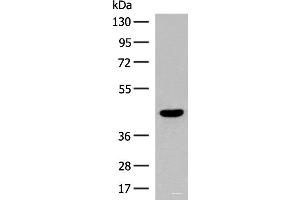 Western blot analysis of Human fetal brain tissue lysate using S1PR5 Polyclonal Antibody at dilution of 1:200 (S1PR5 anticorps)