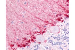 Anti-BAI3 antibody IHC of human brain, cerebellum.