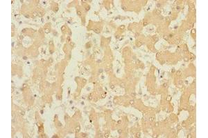 Immunohistochemistry of paraffin-embedded human liver tissue using ABIN7167108 at dilution of 1:100