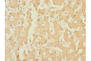 Immunohistochemistry of paraffin-embedded human liver tissue using ABIN7167108 at dilution of 1:100 (RAPGEF4 anticorps  (AA 1-210))