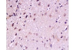 Formalin-fixed and paraffin embedded: rat brain tissue labeled with Anti-TrkB Polyclonal Antibody, Unconjugated  at 1:200, followed by conjugation to the secondary antibody and DAB staining (TRKB anticorps  (AA 32-120))