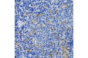 Immunohistochemistry of paraffin-embedded rat spleen using IQG antibody (ABIN7268020) at dilution of 1:200 (40x lens). (IQGAP1 anticorps  (AA 500-750))