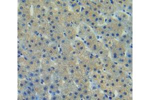 Used in DAB staining on fromalin fixed paraffin- embedded liver tissue (FAK anticorps  (AA 798-1041))